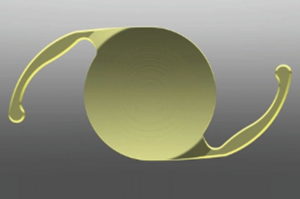 lens implant alcon